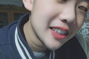 深圳福華口腔怎么樣？附牙齒矯正果圖展示及價格表