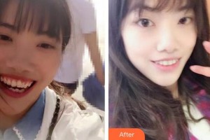 酒泉市口腔醫(yī)院王翠整形價(jià)格表附牙齒陶瓷矯正案例展示