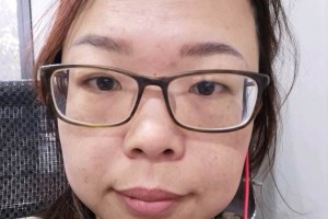 桂林181醫(yī)院有超激光美膚嗎果怎么樣附果圖