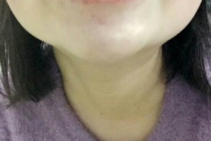 哈爾濱圣安口腔醫(yī)院怎么樣？附牙齒矯正果圖