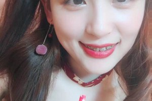 合肥艾雅醫(yī)療美容醫(yī)院怎么樣？附切開雙眼皮對比圖