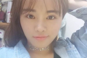 杭州117醫(yī)院整形科主任雙眼皮怎么樣？附果圖展示