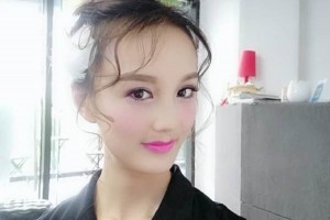 鄭州美立方整形醫(yī)院雙眼皮果好不好？怎么樣？附案例對比圖