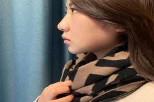 湘雅附二醫(yī)院美容科怎么樣磨骨瘦臉恢復果分享