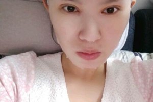 玉林市第一人民醫(yī)院美容科怎么樣附全切雙眼皮案例