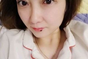 上海復美醫(yī)療美容門診部割雙眼皮日記|價格表