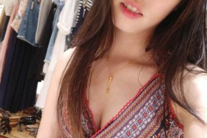 鄭州人民醫(yī)院整形科雙眼皮怎么樣？附手術(shù)果圖及收費(fèi)標(biāo)準(zhǔn)