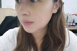 浙醫(yī)一院整形科怎么割雙眼皮案例和價格一覽