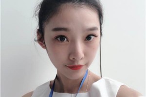 北京碧蓮盛醫(yī)院環(huán)境怎么樣割雙眼皮果分享|價格一覽