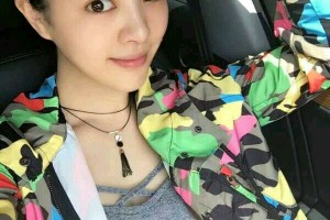 上海星璨整形醫(yī)院好不好隆鼻價(jià)格多少|(zhì)價(jià)格表