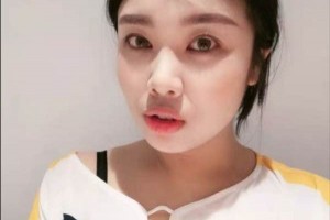 遼寧丹東金澄美容醫(yī)院光子嫩膚果，多久做一次附價格表