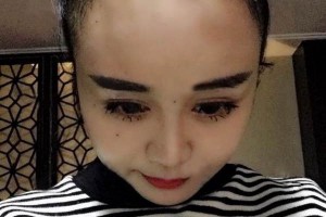 沈陽華美醫(yī)院植發(fā)怎么樣附果圖