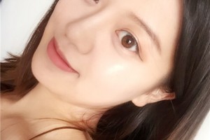 南方醫(yī)院整形科溶脂瘦臉案例分享|醫(yī)生推薦