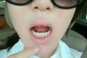 四川口腔醫(yī)院收費(fèi)怎么樣附價(jià)格表