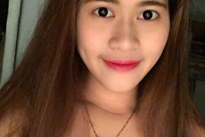 湖南株洲中心醫(yī)院整形科？雙眼皮術(shù)后注意事項！