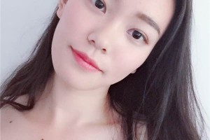 無錫中醫(yī)院整形科如何？雙眼皮成功案例測評分享！