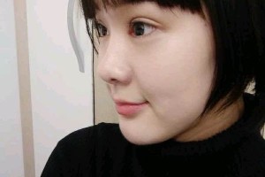 武漢天佑醫(yī)院整形雙眼皮行不行？真人圖片對(duì)比+醫(yī)生推薦