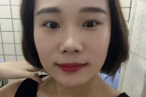 濟(jì)南集美整形醫(yī)院｜雙眼皮真人案例&較新價格表