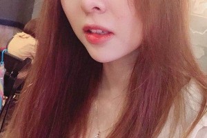 鄭州集美整形醫(yī)院隆鼻真人案例+醫(yī)生介紹！