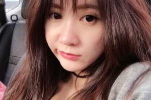 天津一中心整形外科隆鼻怎么樣？真人案例+醫(yī)生介紹