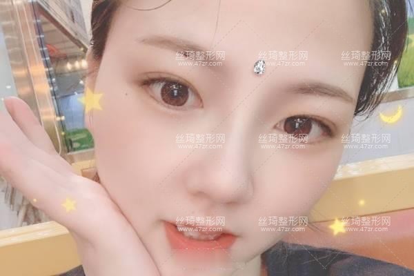 上海生命樹醫(yī)療美容醫(yī)院怎么樣？鼻部手術(shù)價(jià)目表和醫(yī)生推薦