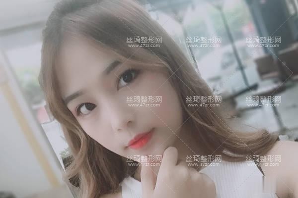 武漢亞太整形隆鼻實(shí)拍案例圖價(jià)格費(fèi)醫(yī)生口碑