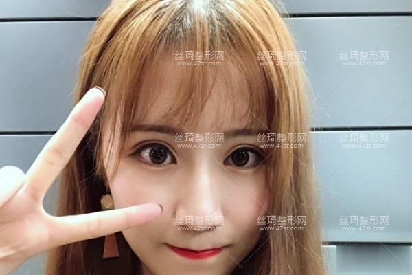 衡陽(yáng)附一美容科隆鼻怎么樣附手術(shù)介紹專家口碑點(diǎn)評(píng)