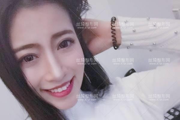 上海華山醫(yī)院整形價(jià)目表隆鼻3個(gè)月果|整形專家詳情