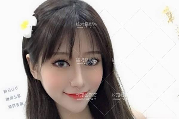 寧波第三醫(yī)院整形美容科怎么樣？鼻部手術(shù)價(jià)目表和醫(yī)生推薦