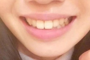 九院正畸科好不好？醫(yī)生名單&2021價(jià)格表