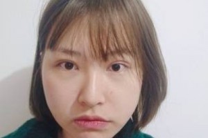 麗港醫(yī)療美容整形醫(yī)院怎么樣？醫(yī)生推薦