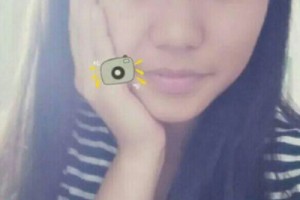 梅州人民醫(yī)院整形科激光嫩膚如何？術(shù)后測(cè)評(píng)-費(fèi)用表