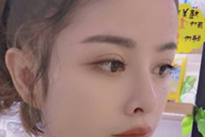 青醫(yī)附院環(huán)境好不好？雙眼皮案例&2021價(jià)格表！