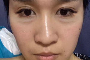 安醫(yī)醫(yī)院隆鼻價目表|醫(yī)院|醫(yī)生介紹