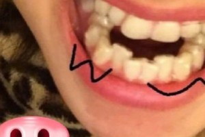 沈陽醫(yī)大正畸比較厲害的醫(yī)生有~全新價格表