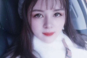 北京協(xié)和醫(yī)院整形外科價格？假體隆鼻術(shù)后恢復(fù)！