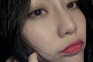 米格醫(yī)療美容醫(yī)院假體隆鼻果？案例+價(jià)格表