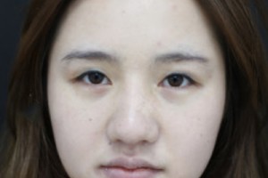 301整形科好不好？醫(yī)院介紹+2021超全價(jià)格表