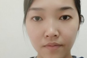 廣州新生毛發(fā)醫(yī)院植發(fā)怎么樣？靠譜嗎？2021價(jià)格表