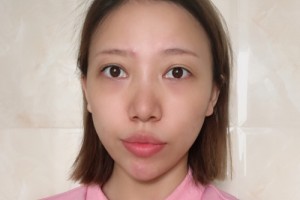 廣州善伊整形口碑如何？醫(yī)生名單+較新費(fèi)用表優(yōu)惠