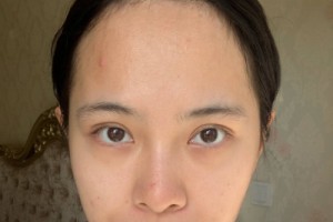 上海九院整形科植發(fā)？掛號(hào)難不難網(wǎng)上掛號(hào)攻略