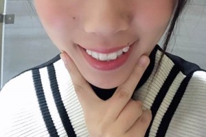 洛陽友好口腔口碑｜真實分享&醫(yī)生介紹