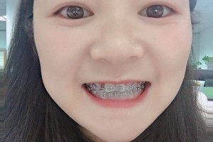 沈陽(yáng)康貝佳口腔牙齒矯正怎么樣/醫(yī)生介紹+名單！