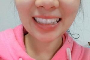 長沙市口腔醫(yī)院牙齒矯正多少錢？案例測評+價格表