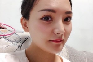 鄭大一附院整形科/下頜角案例果&價格表