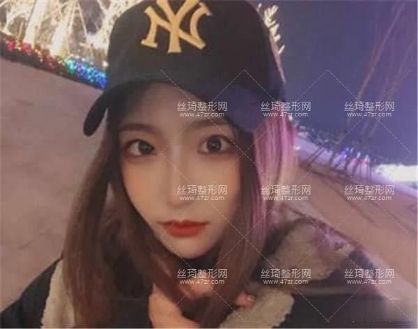 上海第九人民醫(yī)院美容整形科怎么樣？隆鼻實(shí)拍案例圖價(jià)格費(fèi)醫(yī)生口碑