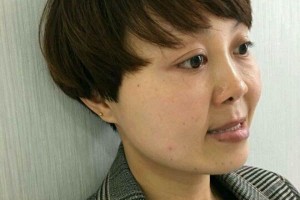 東莞健力口腔｜牙齒矯正術(shù)后反饋+醫(yī)生介紹