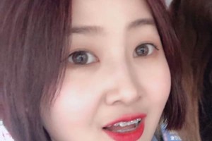 連云港口腔醫(yī)院牙齒矯正價(jià)格表｜醫(yī)生介紹