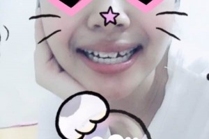 青島可恩口腔醫(yī)院牙齒矯正靠譜嗎？圖片對比+價格表