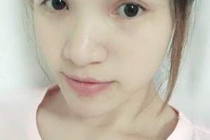 上海千美整形醫(yī)院\術(shù)后案例必看